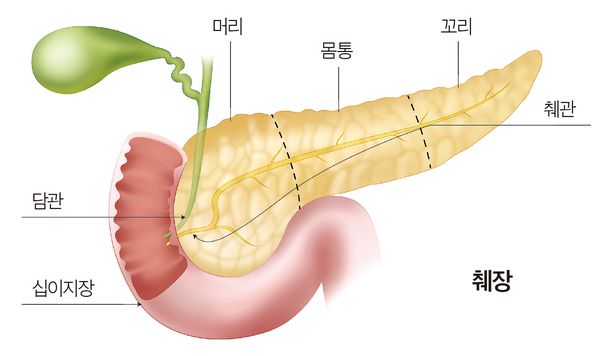 “췌장암, 조기진단 어렵고 신약개발 더뎌…5년생존율 최저”