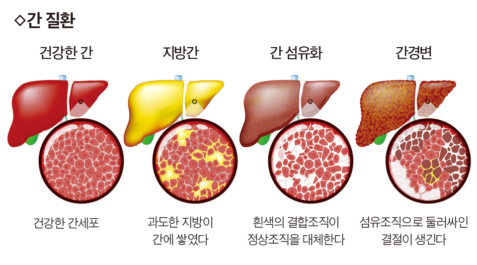 간치료에 대해 살펴보겠습니다.