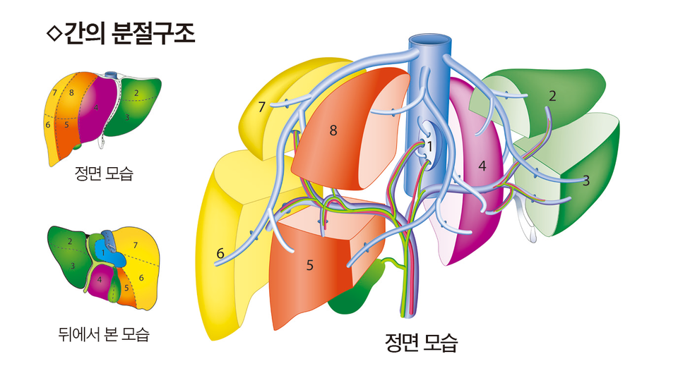“간 절제수술 실패율 1% 미만…잘라내도 한 달이면 커져”