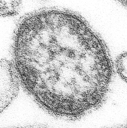 홍역 바이러스의 전자현미경 사진. [사진=Public Domain]